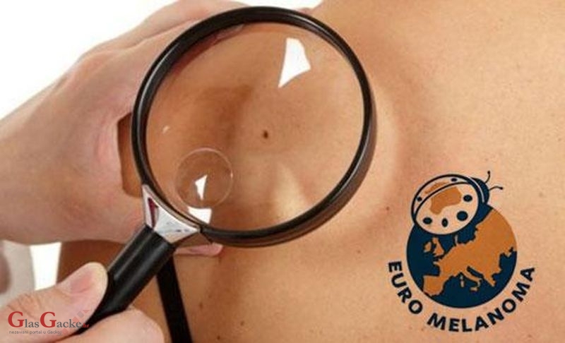 Besplatni pregled madeža