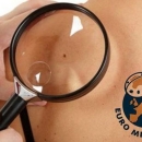Besplatni pregled madeža